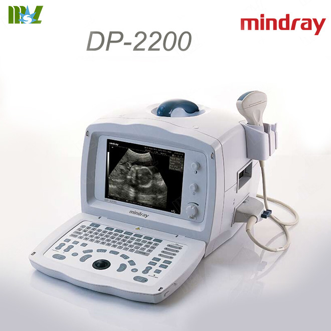 mindray ultrasound price