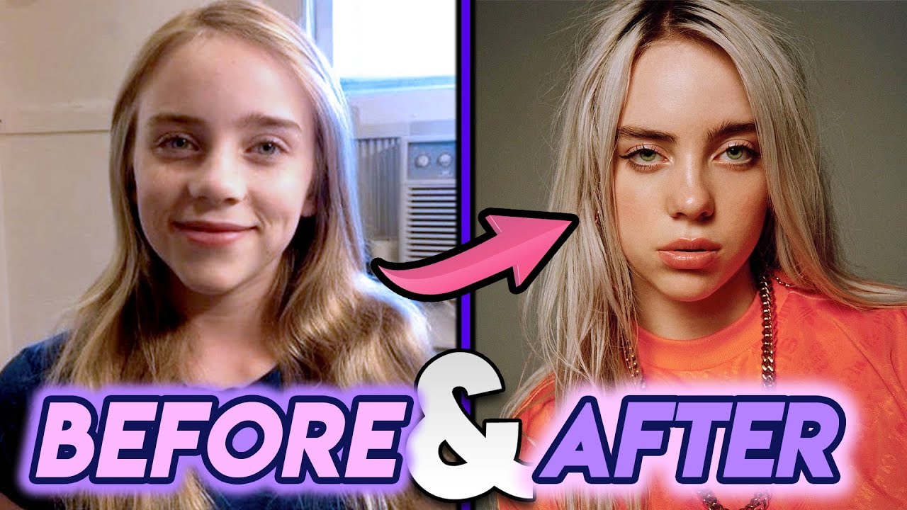 billie eilish plastic surgery