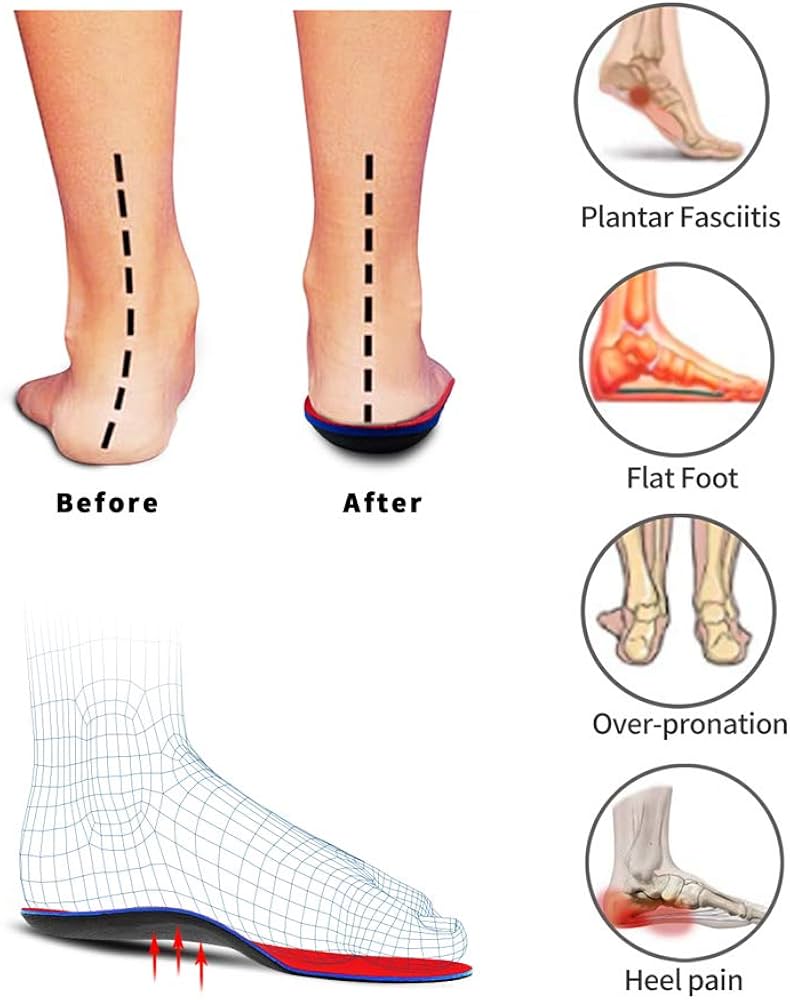 best foot inserts for flat feet