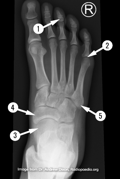 radiopaedia quiz