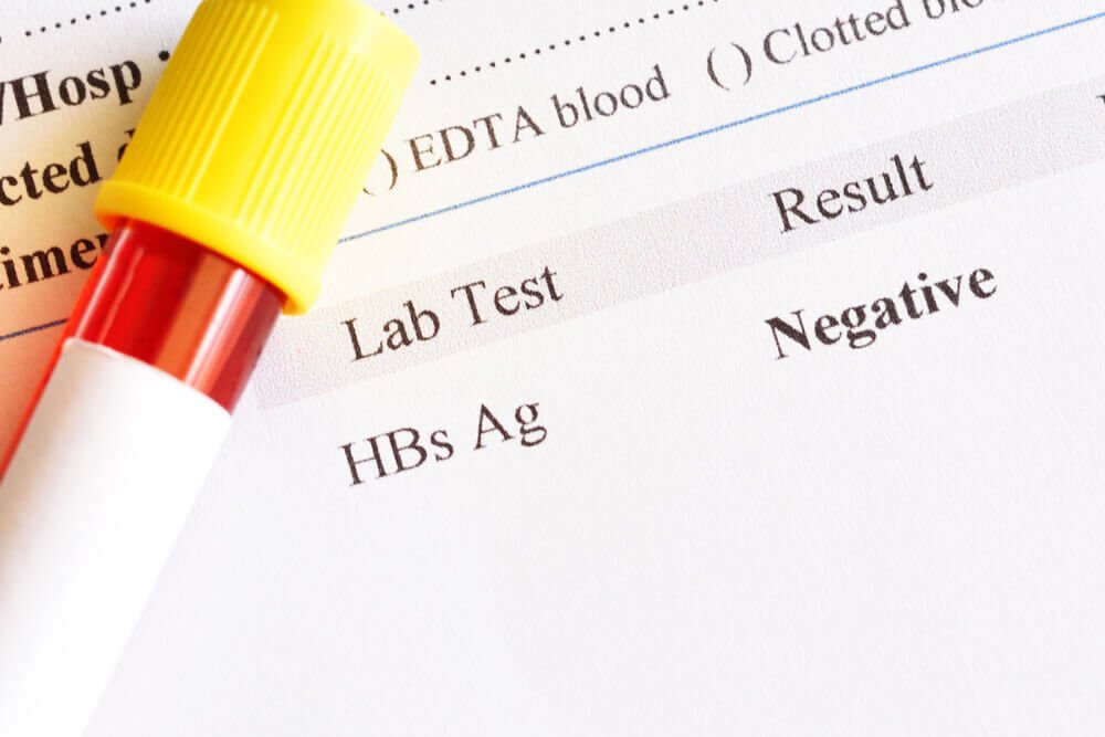 anti hbs mikropartikül immün assay meia veya benzeri ne demek