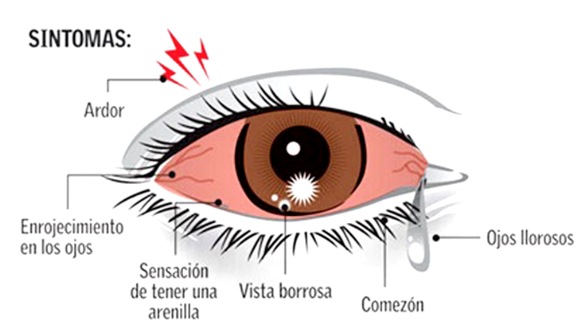 como se coge la conjuntivitis