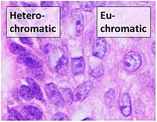 hetrochromatic