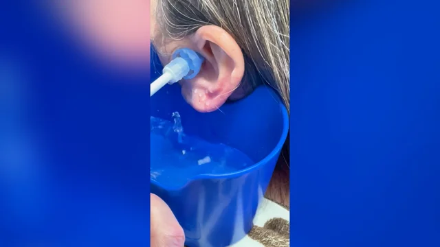 ear wax removal san antonio