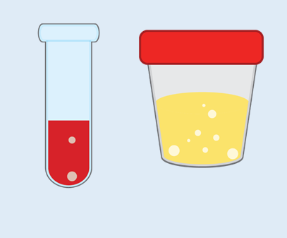 labcorp test code for 24 hour urine calcium