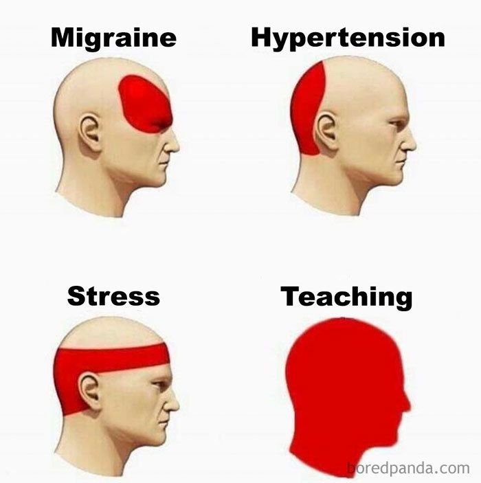 migraine headache meme