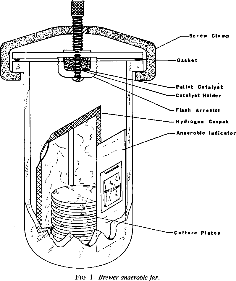 anaerobic jar diagram