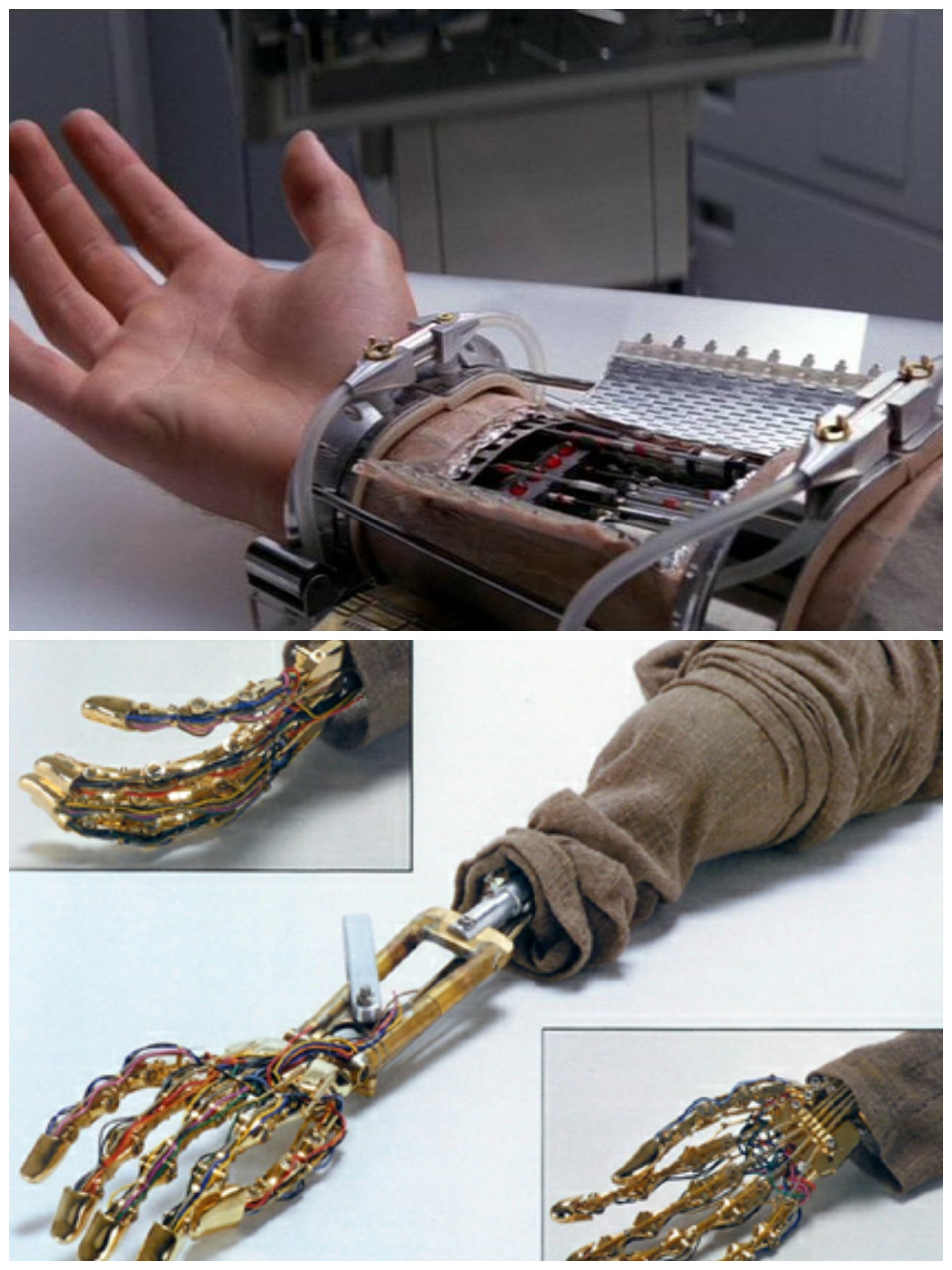 anakin mechanical arm