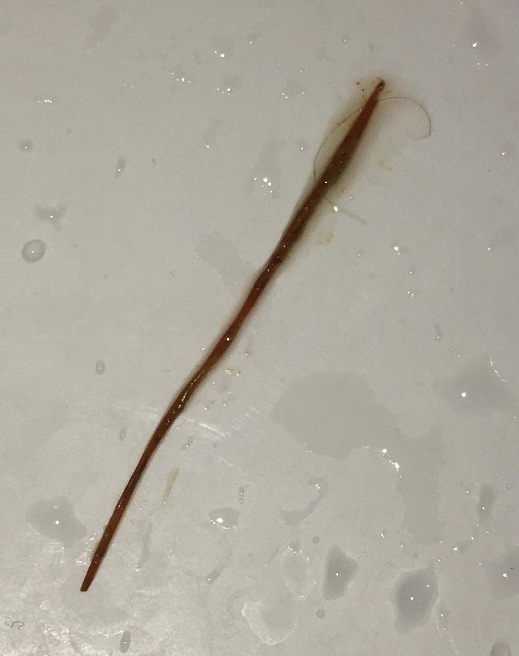 fiber strings in poop