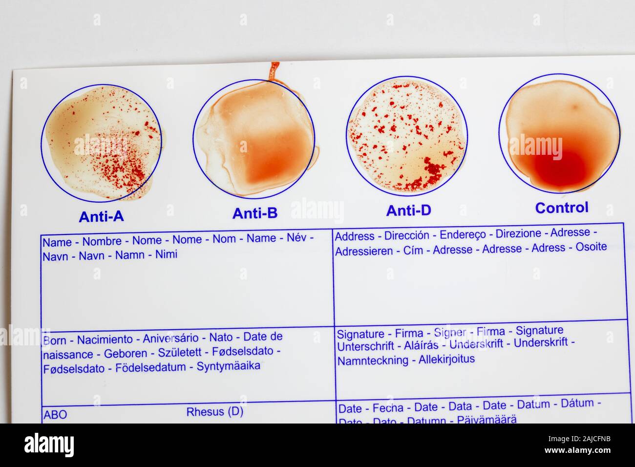 ati type test result