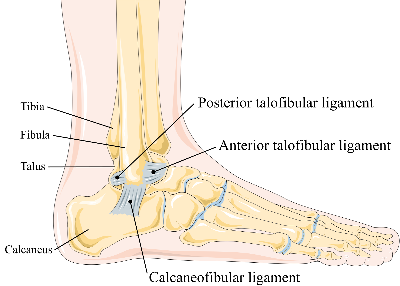 sprain of ankle icd 10