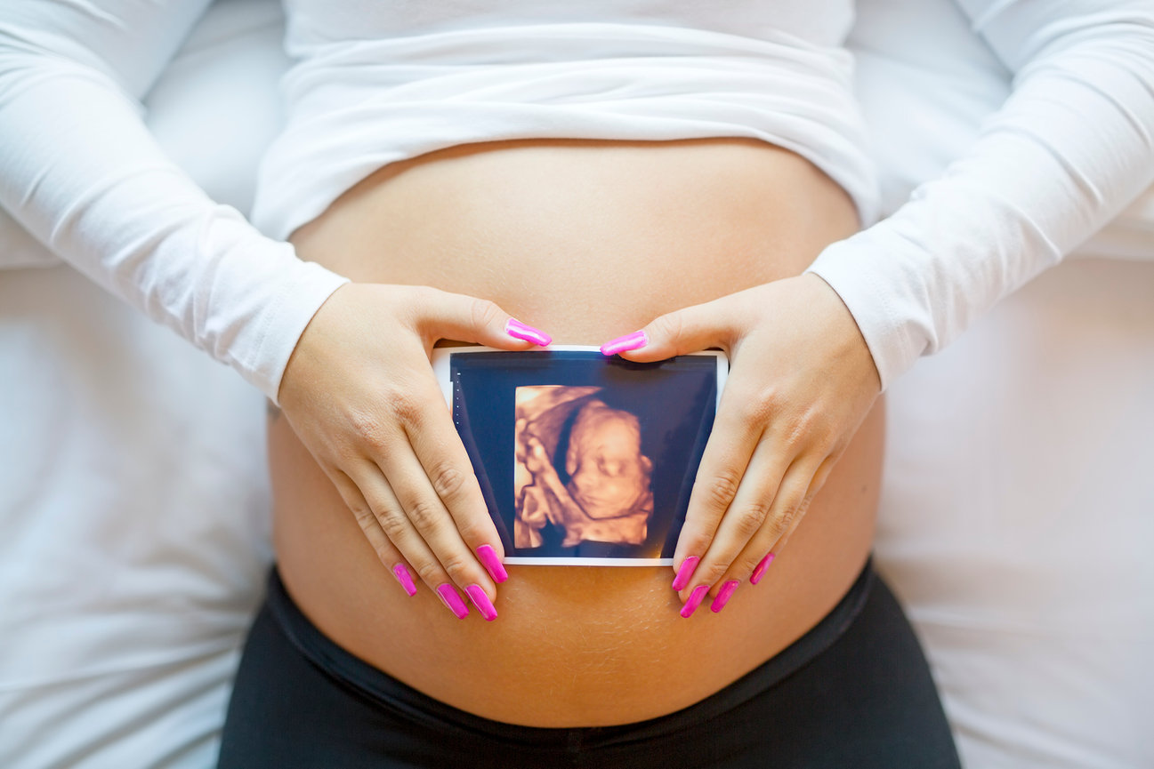 3d sonogram dallas