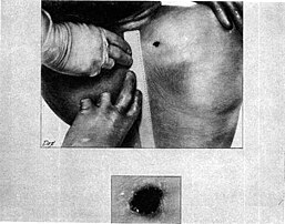 kennedys autopsy