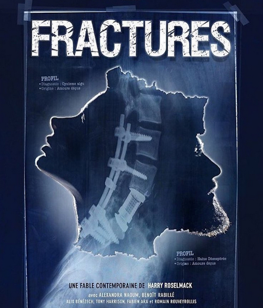 fracture imdb