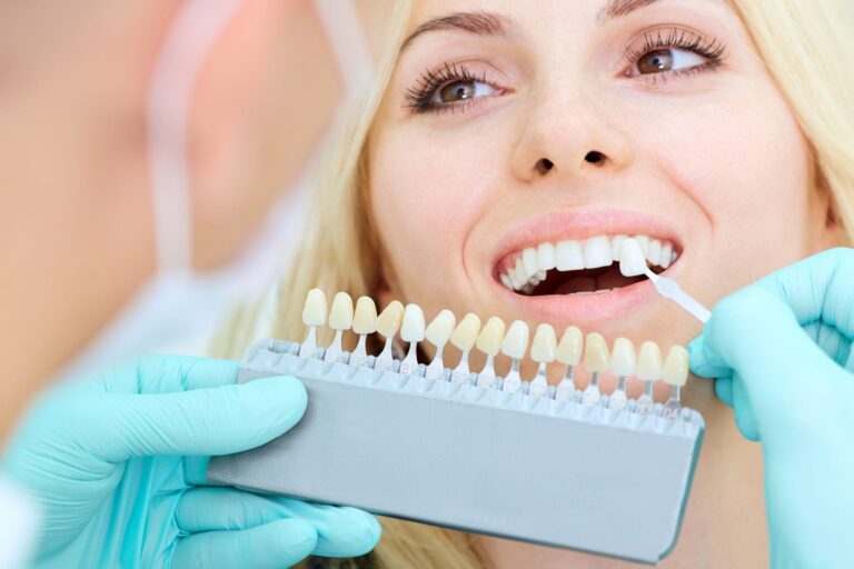 dental veneer consultation maple ridge