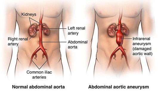 left side of stomach pulsing