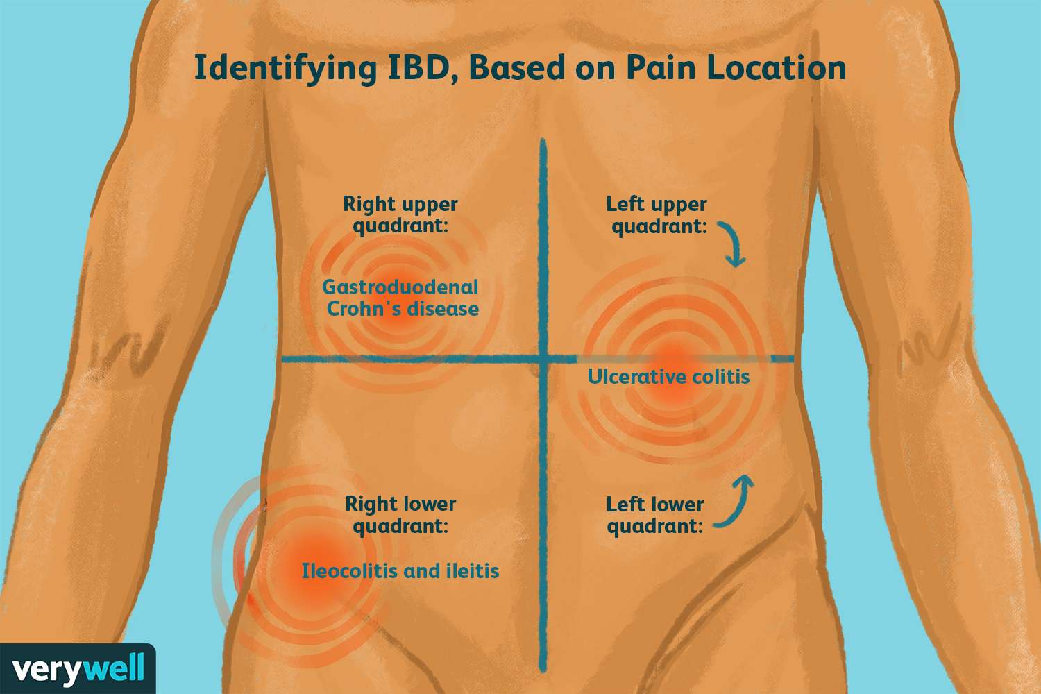 sharp sudden pain under right rib cage