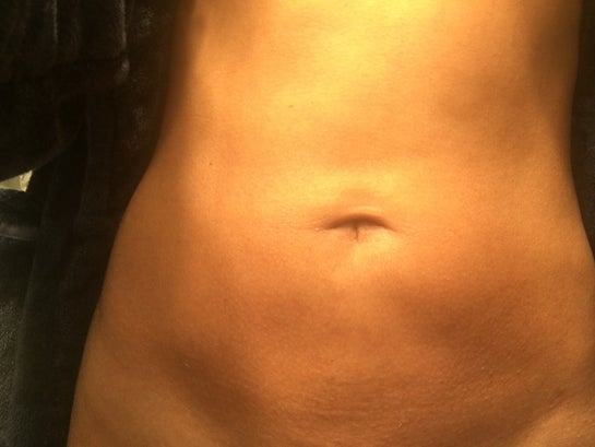 t shaped belly button