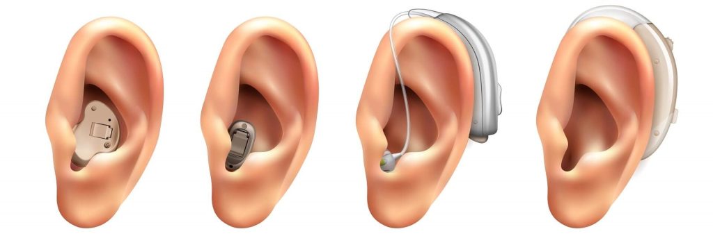 hearing aid in siliguri