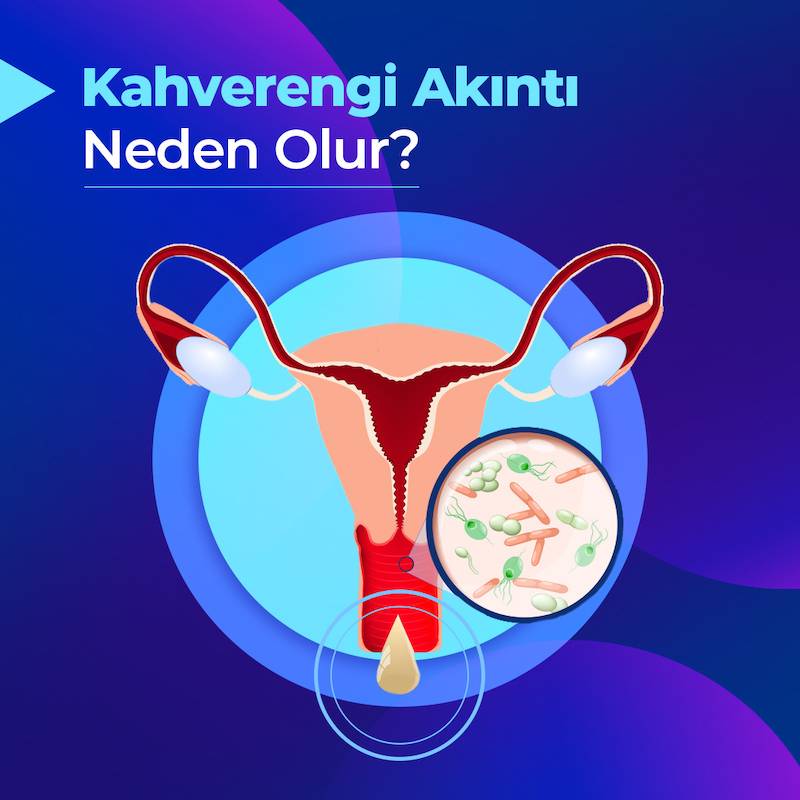 adet olmam gerekirken kahverengi akıntı geldi kadınlar kulübü