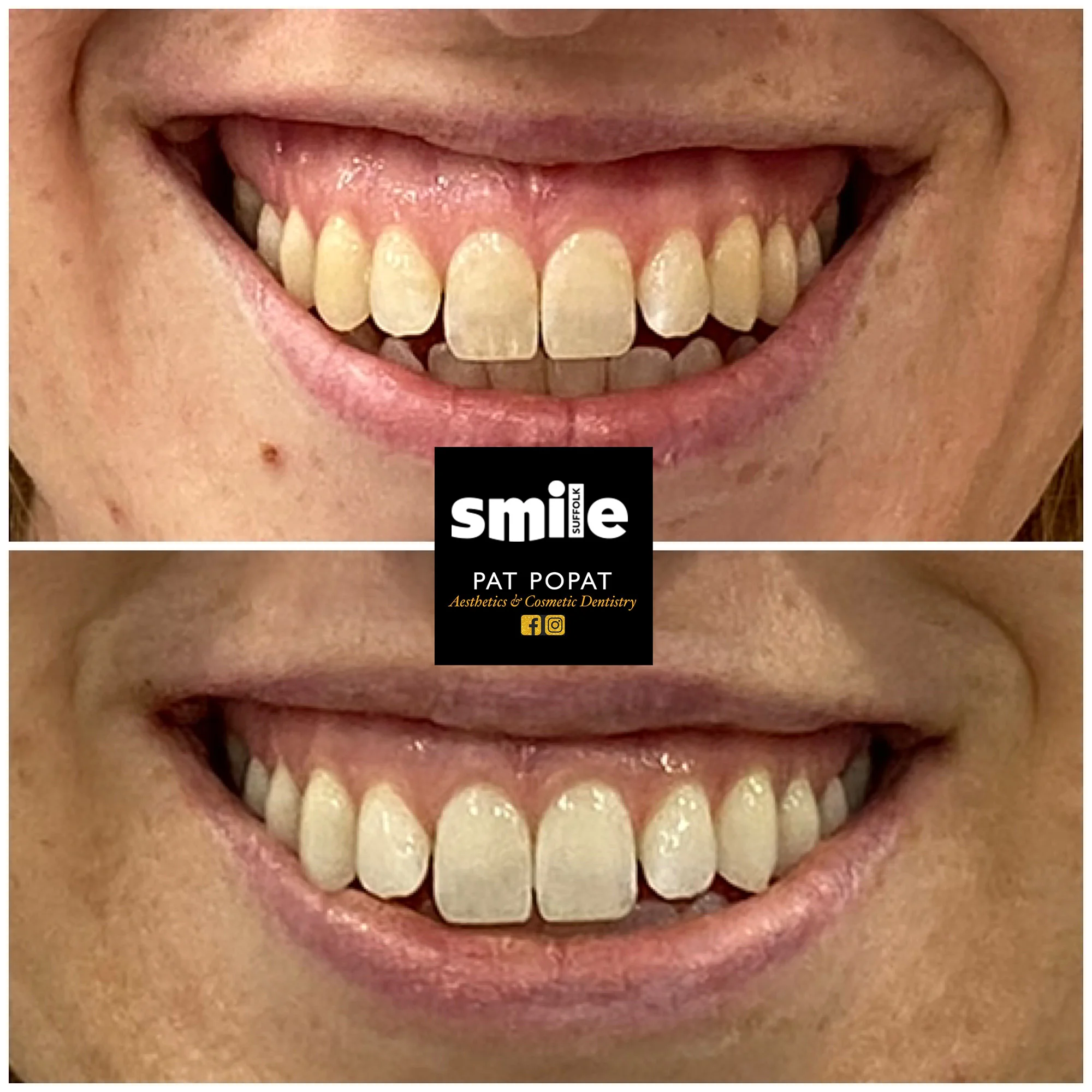 smile rejuvenation northern suffolk