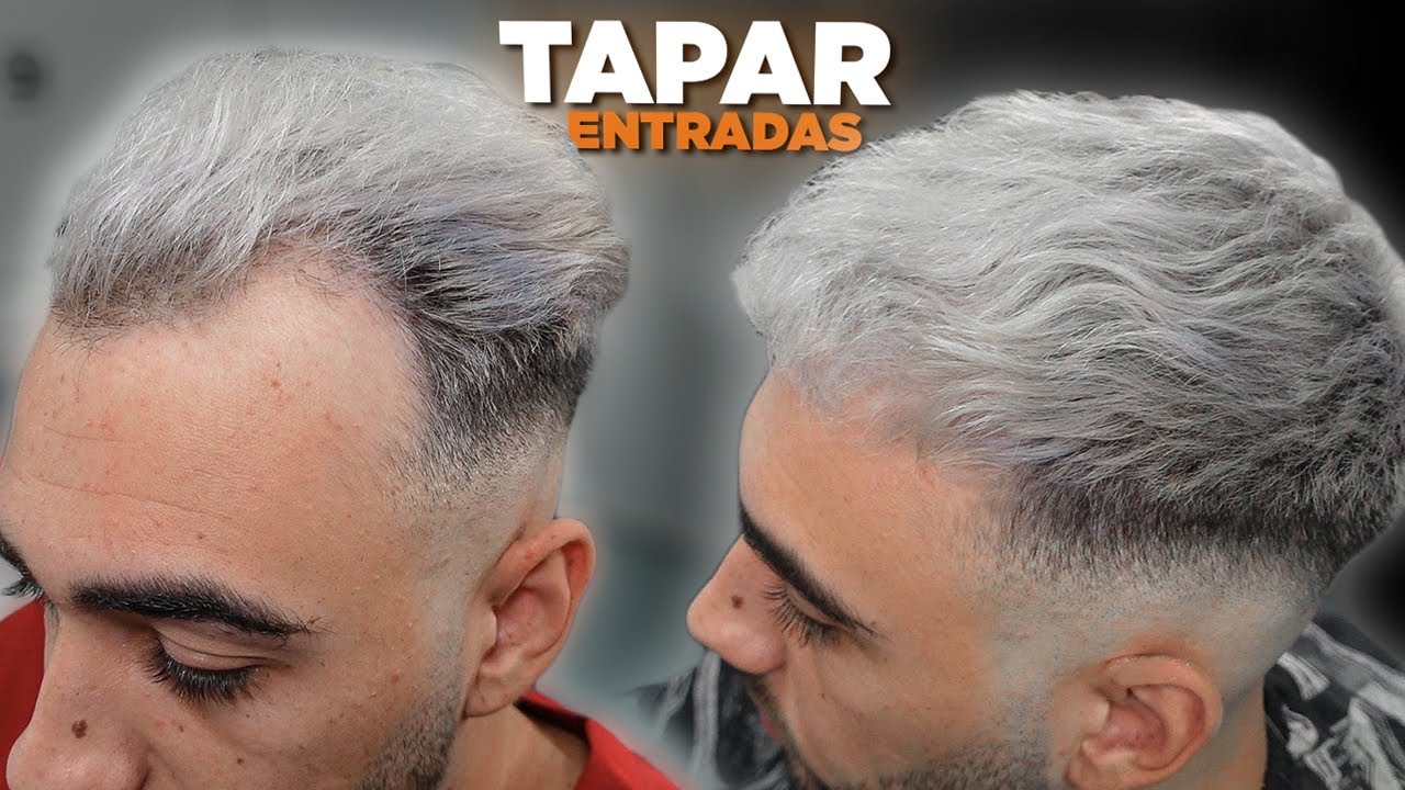 cortes de pelo corto hombre con entradas