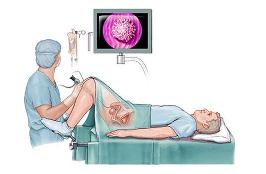 cystoscopy price philippines