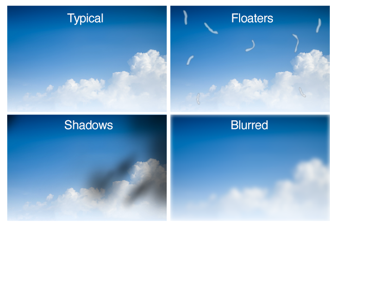 seeing shadows in vision