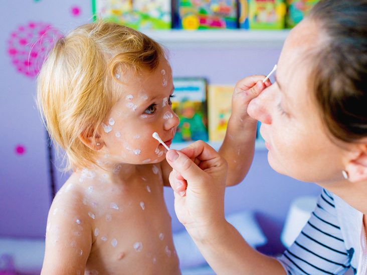 oatmeal bath for chickenpox boots