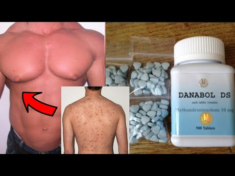 side effects dianabol