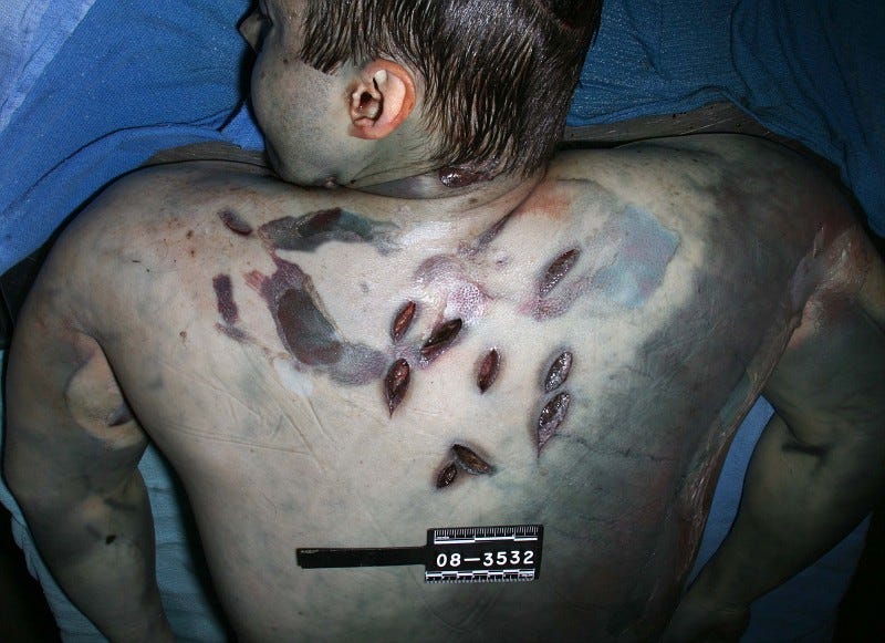 travis alexander autopsy photos