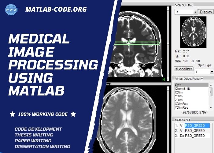 imaging matlab