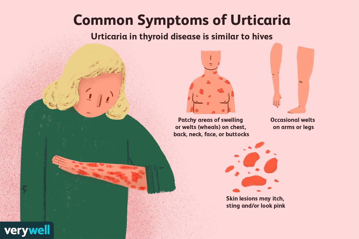 thyroid skin rash pictures face