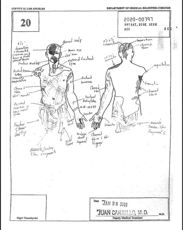 gigi bryant autopsy