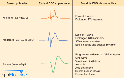 hyperkalemia ecg changes ati