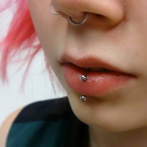 infected vertical labret