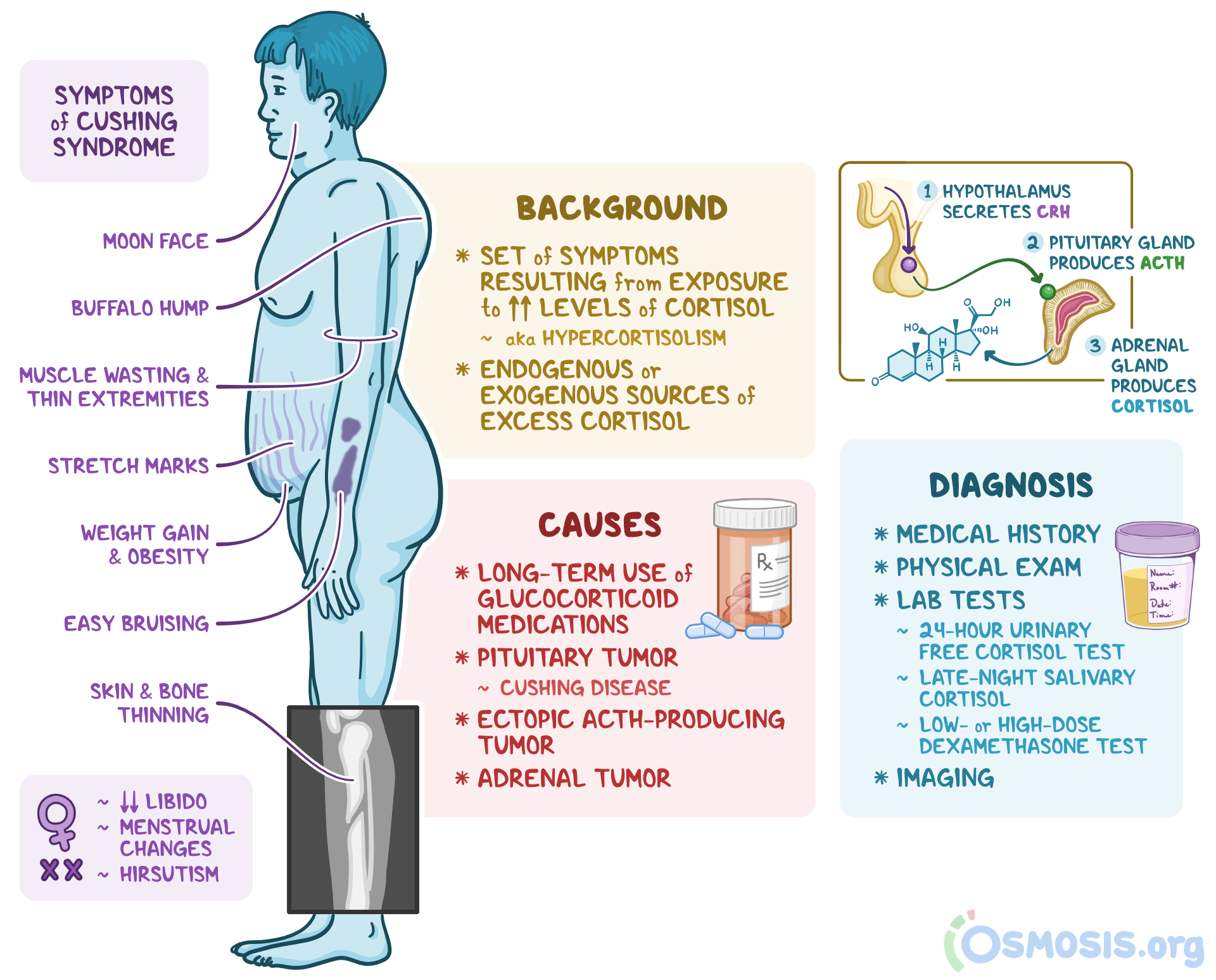 is cushing syndrome treatable