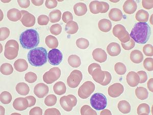 lymphocytes 中文