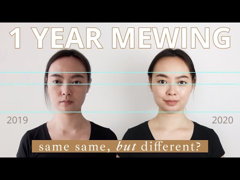 mewing at 25