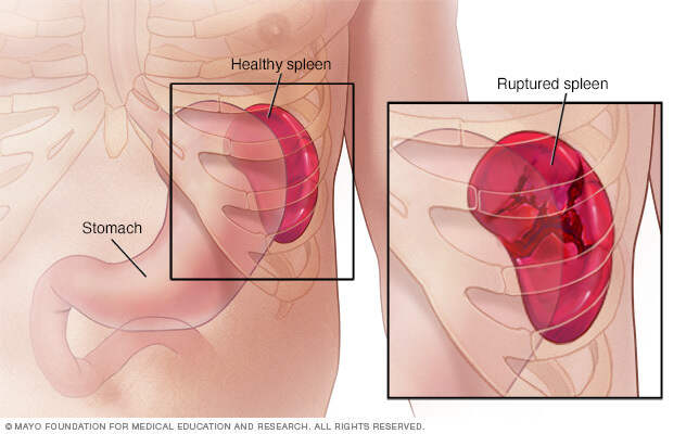 pain under bottom left rib