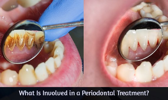 periodontist brampton