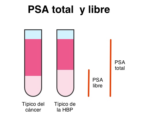 ratio psa libre/psa total 0 17