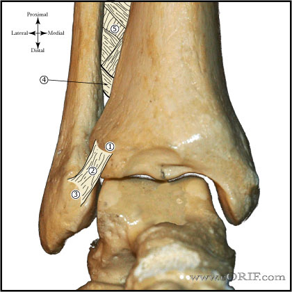 right ankle sprain icd 10