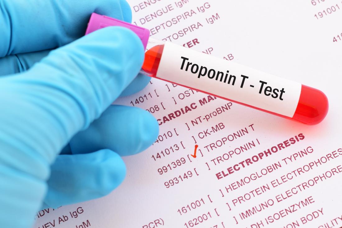 troponin c nedir