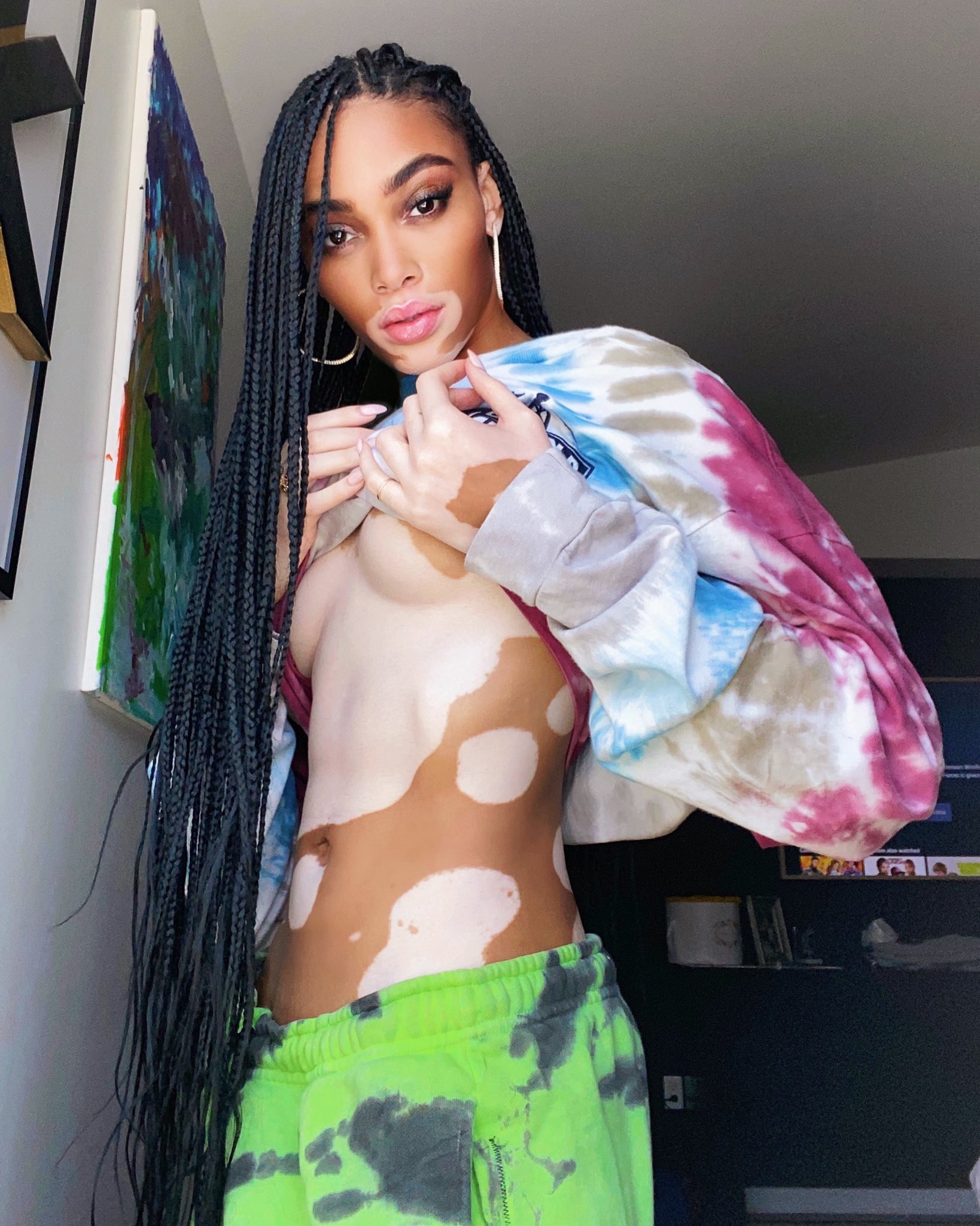 winnie harlow nude